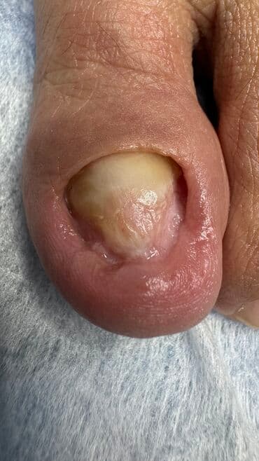 самый лучший эндокринолог рядом просп жибек жолу бишкек: Наращивание ногтей, Укрепление ногтей, Ремонт сломаных ногтей, Маникюр, Педикюр, С выездом на дом, Консультация, Одноразовые расходные материалы — 2