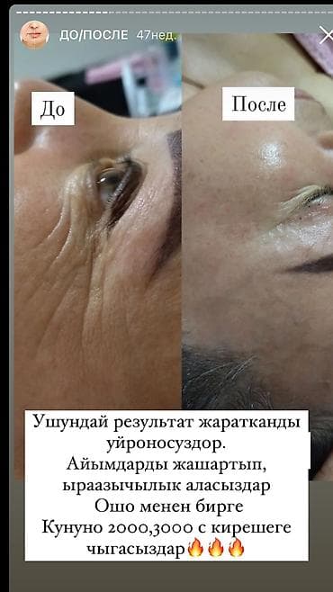курсы массаж лица: Курсы | Косметологи-визажисты Выдается сертификат, Предоставление расходного материала, Предоставление моделей — 3
