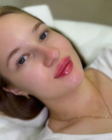 Косметология, Увеличение губ, Консультация