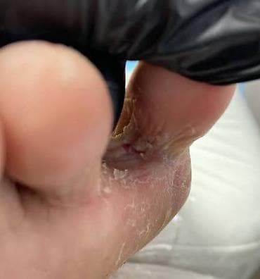 фф бета: Носки с отдельными пальцами (пять пальцев) Размер 35-43 Убирает грибки — 3