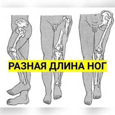 женские брендовые туфли недорого: Стельки для роста (7 видов) Цена за пару Адрес: Лермонтова — 12