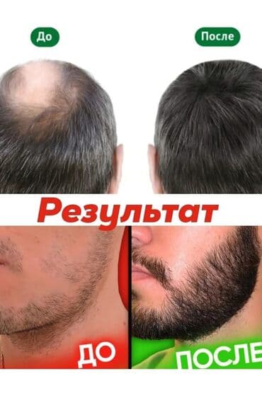 эко спрей от вшей как пользоваться: Триоксидил Trioxidil Стимулирующая рост волос процедура для мужчин и — 5