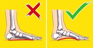 белорусская обувь для проблемных ног бишкек: Стельки ортопедические(специализированные) от плоскостопия Для — 1