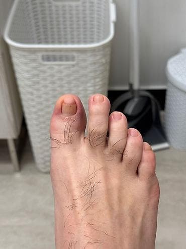 орт книжки: Коррекция вросших ногтей, Услуги подолога, С выездом на дом, Консультация, Одноразовые расходные материалы — 10