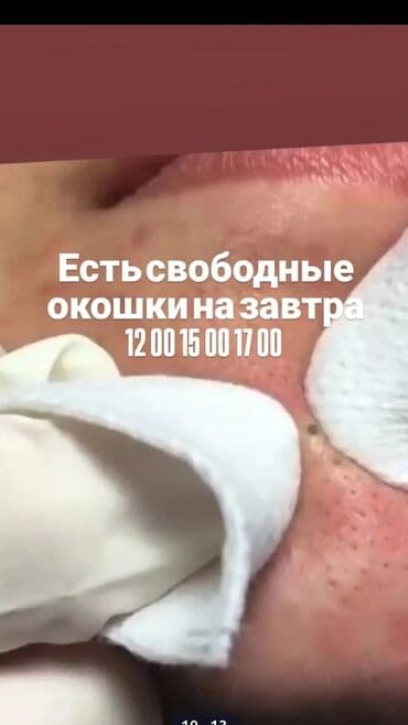 лучшие дерматологи бишкека: Косметолог с медицинским образованием чистка лица пилинг осветление — 10