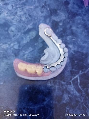 фиксатор голеностоп: Съемные частичные зубные протезы - Тип: частичные протезы для верхней — 9