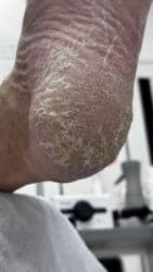 арендовать дом: Выравнивание, Услуги подолога, С выездом на дом, Консультация, Одноразовые расходные материалы — 34