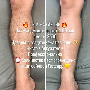 шугаринг эпиляция зон: Депиляция для женщин и мужчин — Sugaria Sugaring & Beauty просьба — 7