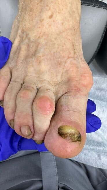 сколько стоит обучение на мастера маникюра: Коррекция вросших ногтей, Маникюр, Педикюр, Услуги подолога, Консультация, Одноразовые расходные материалы — 3