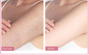 личный кабинет эрсаг кыргызстан: ❄️ скраб с отбеливающим увлажняющим и питающим эффектом умывашка — 17