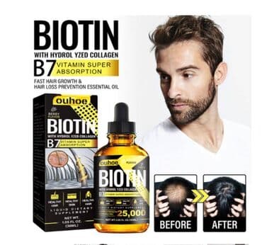 шампунь дисаар: ❄️ США От выпадения волос от облысения от алоп еции для густоты волос — 3