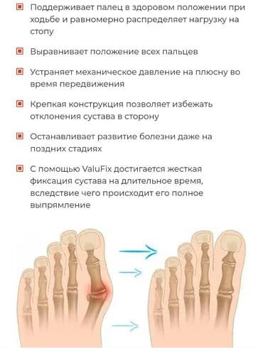 Кислородные подушки: Valufix- hallfix фиксатор от вальгусной деформации +бесплатная — 28