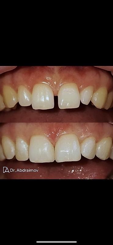 жумуш баня: Дарыгерлер | Стоматолог | Диагностика, Консультация, Башка медициналык кызматтар — 4