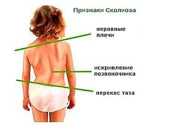 Корсеты, корректоры осанки, пояса для спины, реклинаторы 9-11