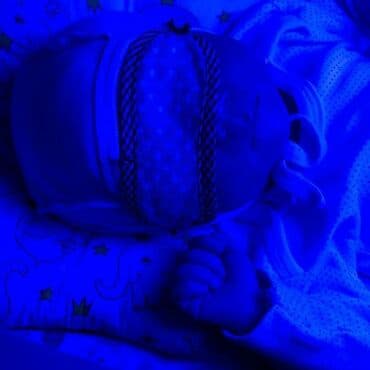 фотолампа для новорожденных: Медицинские лампы от желтухи (билирубин)Лампа для лечения желтушки — 2