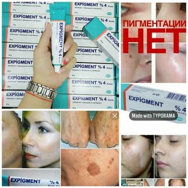 Expigment для пигментации. В составе гидрохинон.Производство Турция