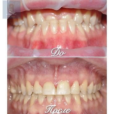 работа для врача: Ортодонтическое лечение: исправление прикуса и выравнивание зубных — 1