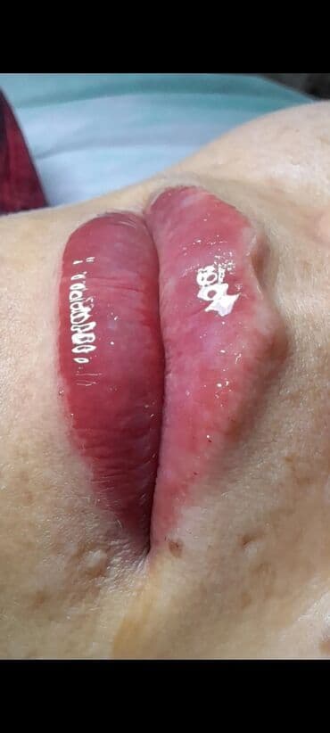 сколько стоит обучение на маникюр: Косметология, Биоревитализация, Ботулинотерапия, Сертифицированный косметолог, Гипоаллергенные материалы, Консультация — 10