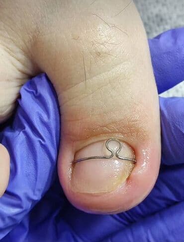 сколько стоит обучение на мастера маникюра: Выравнивание, Наращивание ногтей, Донаращивание ногтей, Маникюр, Педикюр, Услуги подолога, Консультация — 5