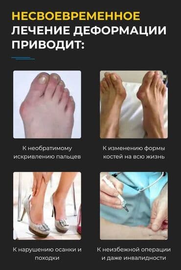 Кислородные подушки: Valufix- hallfix фиксатор от вальгусной деформации +бесплатная — 24