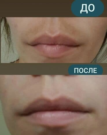 эффективный отбеливающий крем для зоны бикини в аптеке: Expigment Экспигмент Сроки до 2027 Свежая поставка с Турции 🇹🇷 💯% — 6