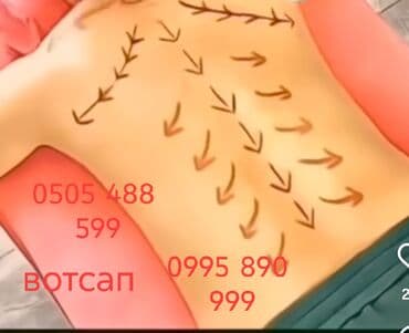 Массаж | Лечебный массаж | Холка на шее | Консультация