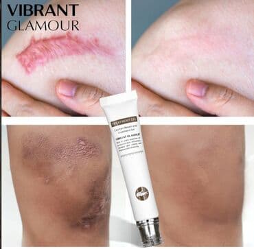 личный кабинет эрсаг кыргызстан: Гель для удаления шрамов VIBRANT GLAMOUR, содержит натуральные — 3