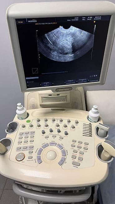 Нитриловые перчатки: Ультразвуковая система Medison SonoAce X8 - Стационарный УЗ-сканер на — 2