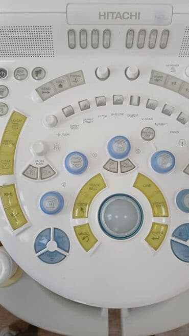 Кычкылтек жаздыктары: Продаю или сдаю УЗИ аппарат Хитачи Прейрус в отличном состоянии — 4
