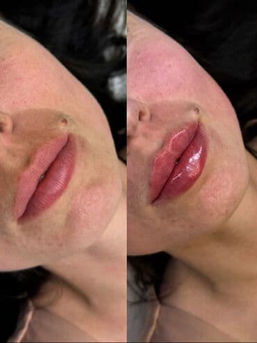 нейлоновые зубные протезы в бишкеке цены: Косметология увлажнение кожи лица ботекс и многое другое Для мужчин — 8