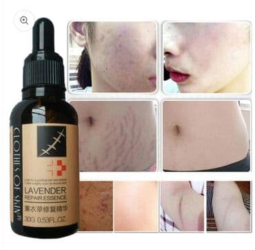 растяжки: Восстанавливающая эссенция LAVENDER . Масло для удаления растяжек и — 3