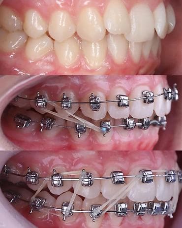 ортопедическое кресло бишкек: Скамейка Металл — 9