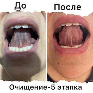 hp 476: СПРЕЙ «СНЕЖНАЯ ОРХИДЕЯ» Что это за продукт? Снежная Орхидея — это — 9