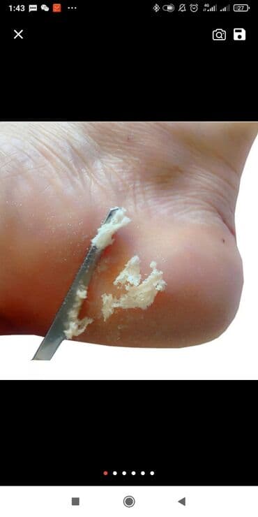 сколько стоит обучение на маникюр: Выравнивание, Наращивание ногтей, Донаращивание ногтей, Маникюр, Педикюр, Услуги подолога, Консультация, Одноразовые расходные материалы — 2