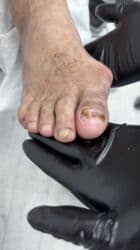 арендовать дом: Выравнивание, Услуги подолога, С выездом на дом, Консультация, Одноразовые расходные материалы — 33