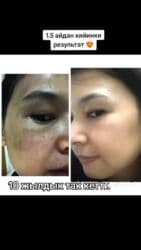 h2 premium магний водород инструкция: Так,сепкил,куперез и бырышка 👍🔥Самый эффективный сыворотка крем 💯 — 22