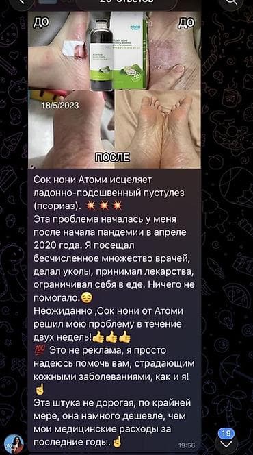 nutrien купить: Атоми Ферментированный Концентрат Нони Хз эй - Функциональный — 4