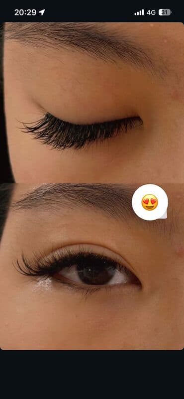 сколько стоит поставить брекеты на зубы в бишкеке: Наращивание ресниц все эффекты всего за 1000с адрес Чуй 127 — 2