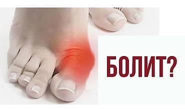 Фиксаторы большого пальца (от вальгуса) Ночные и дневные Цены от 350 at lalafo.kg Фиксаторы большого пальца (от вальгуса) Ночные и дневные Цены от 350