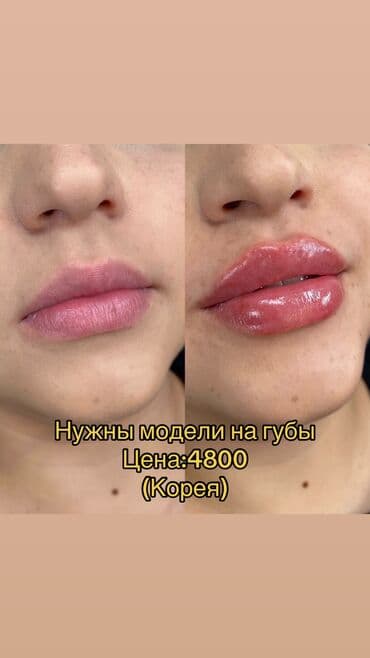 Косметология, Ботокс, Ботулинотерапия, Плазмолифтинг, Гипоаллергенные материалы, Консультация, Сертифицированный косметолог