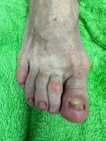 сколько стоит обучение на мастера маникюра: Коррекция вросших ногтей, Маникюр, Педикюр, Услуги подолога, Консультация, Одноразовые расходные материалы — 5