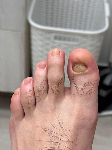 орт книжки: Коррекция вросших ногтей, Услуги подолога, С выездом на дом, Консультация, Одноразовые расходные материалы — 8