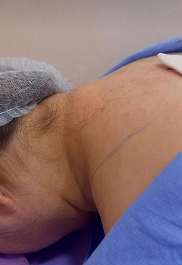 Бани, сауны, SPA: --Саламатсызбы 💎 ЭЭК АСТЫ ЖАНА ХОЛКА ЛИПОСАКЦИЯСЫ *Ээк асты – — 5