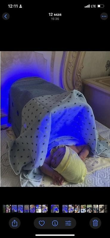 груди: Фотолампа от желтушки! Лечение желтушки у новорожденного с помощью — 3