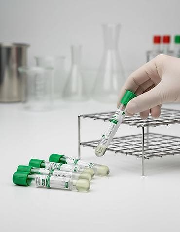Медтовары: Пробирки для плазмолифтинг зеленые с гепарином натрия и разделитель — 1