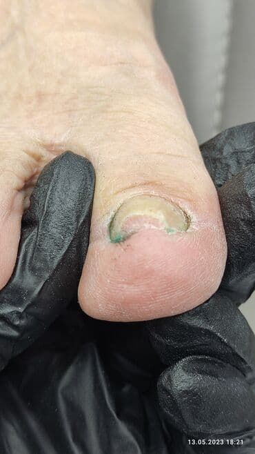 сколько стоит обучение на мастера маникюра: Коррекция вросших ногтей, Маникюр, Педикюр, Услуги подолога, Консультация, Одноразовые расходные материалы — 3