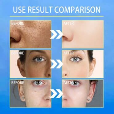 крем день и ночь китайский отзывы: ❄️ сша крем интенсивный отбеливающий антивозрастной ▶ быстрое — 2