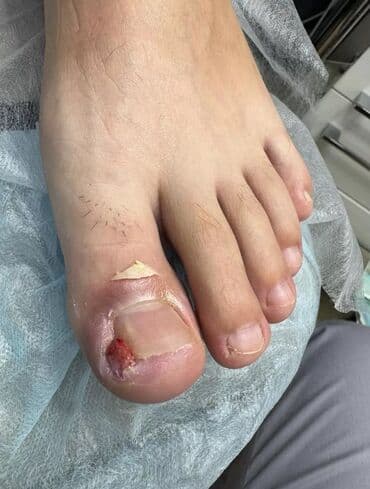 на дом керек: Услуги подолога, С выездом на дом, Консультация, Одноразовые расходные материалы — 1