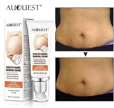 Крем для удаления растяжек AUQUEST. Можно убрать растяжки на теле