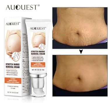 растяжки: Крем для удаления растяжек AUQUEST. Можно убрать растяжки на теле — 1